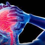 Epilepsi Hastalarına Verilen Engelli Oranı Nedir