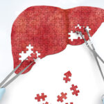 Hepatit Hastaları İçin Engelli Oranı Ne Kadar